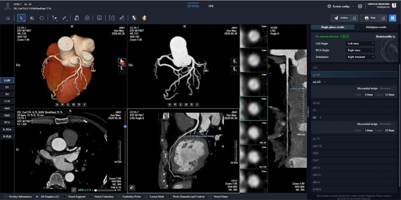 CT CCTA
