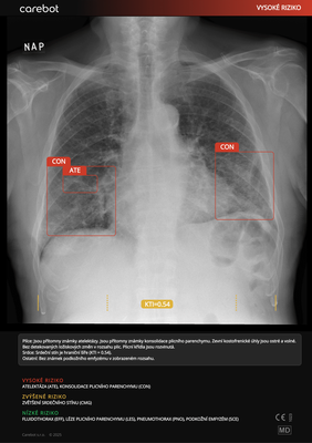 Carebot AI CXR - 2.8.XX_04