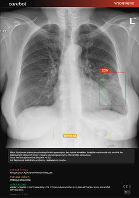 Carebot AI CXR - 2.8.XX_05