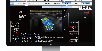 amcad-biomed-amcad-ut_1.PNG