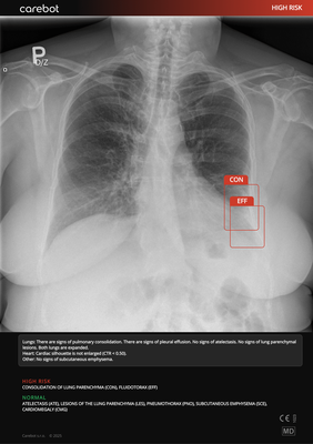carebot-ai-cxr-1