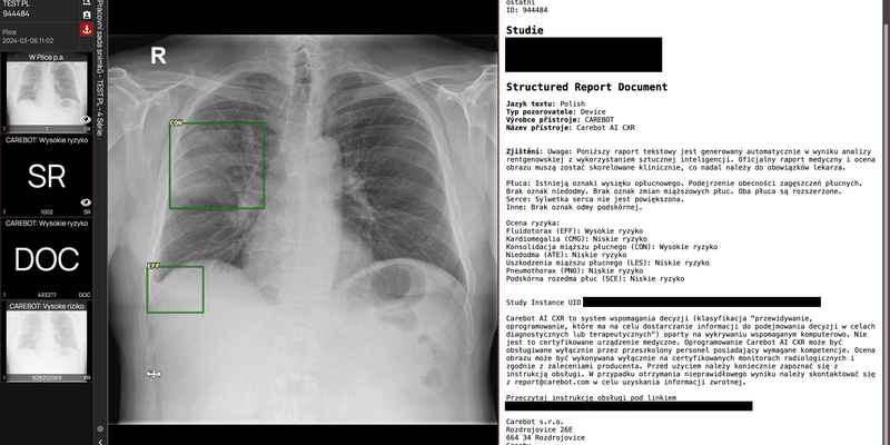 carebot-ai-cxr_3.png