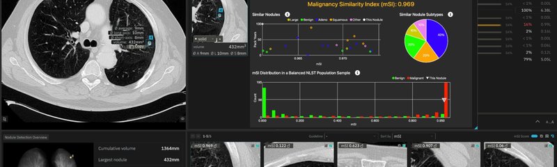 contextflow ADVANCE Chest CT 3.0 - INSIGHTS with mSI Report