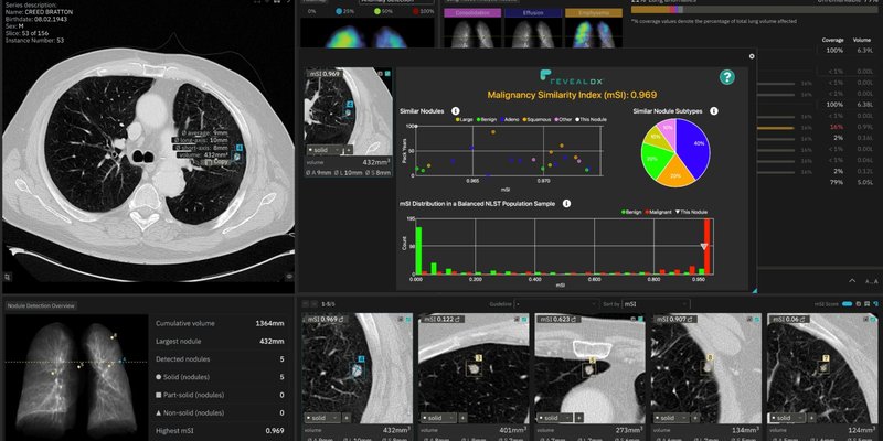 contextflow ADVANCE Chest CT 3.0 - INSIGHTS with mSI Report