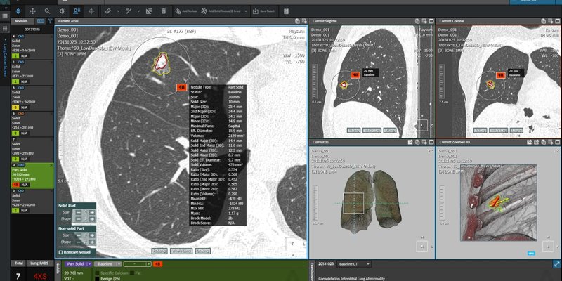 coreline-soft-aview-lcs (2).jpg