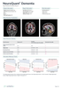 cortechs-ai-neuroquant-brain (10).png