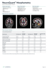 cortechs-ai-neuroquant-brain (11).png