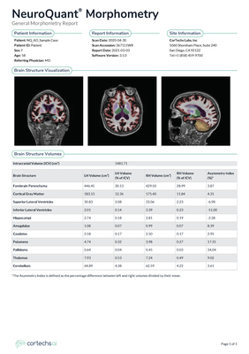 cortechs-ai-neuroquant-brain (11).png