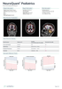 cortechs-ai-neuroquant-brain (4).png