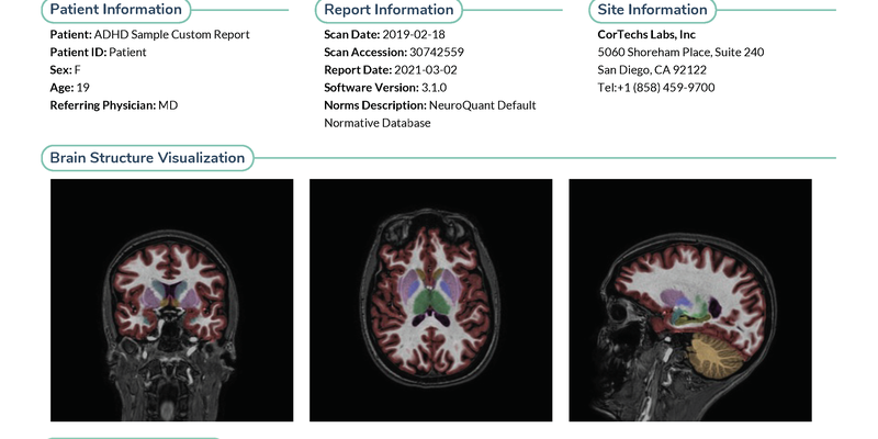 cortechs-ai-neuroquant-brain (8).png