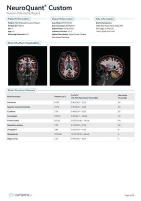 cortechs-ai-neuroquant-brain (8).png