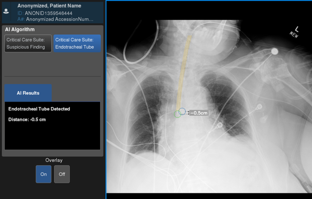 ge-critical-care-suite_1.png