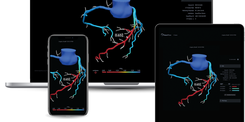 heartflow-ffrct-analysis.png