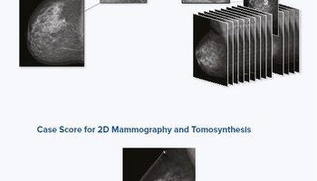 icad-profound-ai-for-digital-breast-tomosynthesis_1.jpg