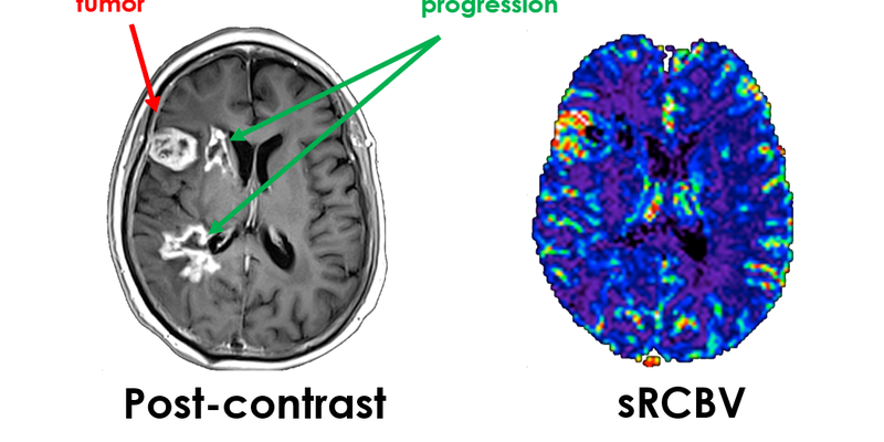 imaging-biometrics-neuro.png