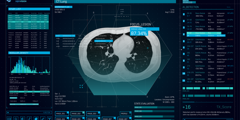 infervision-ct-lung.png