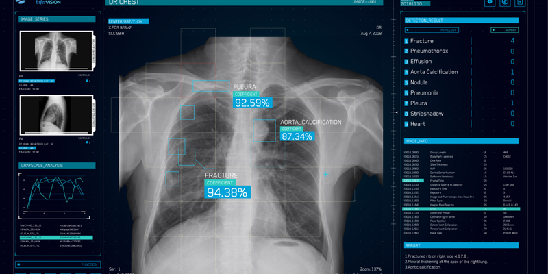 infervision-dr-chest.png