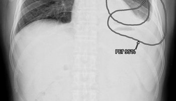 lunit-insight-cxr3_6.jpg