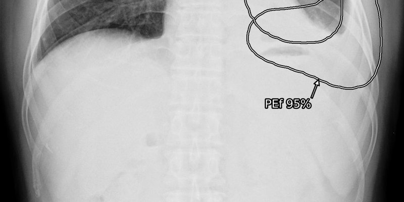 lunit-insight-cxr3_6.jpg