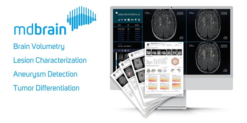 mediaire-mdbrain