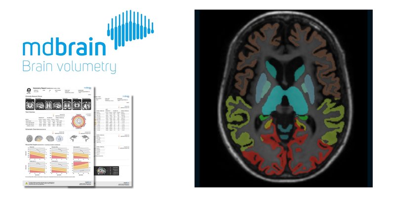 mediaire-mdbrain_1.jpg