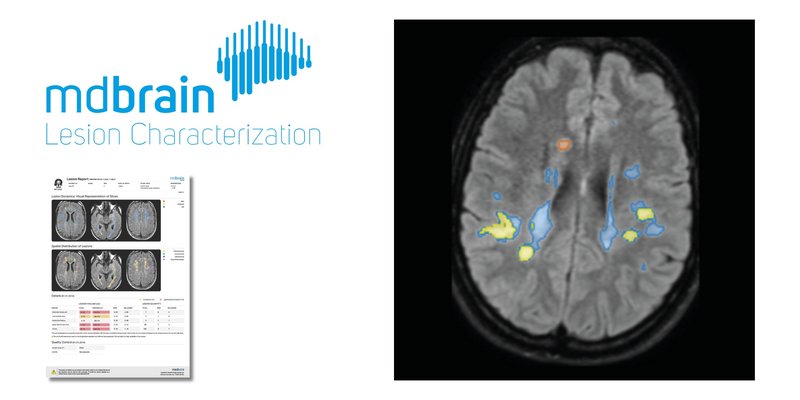 mediaire-mdbrain_2