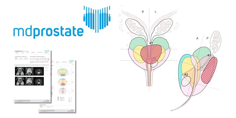 mediaire-mdprostate (1).jpg