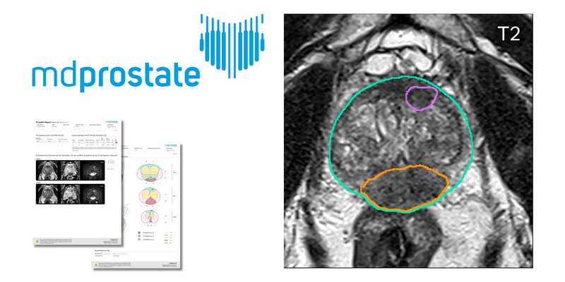 mediaire-mdprostate (3).jpg