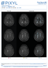 pixyl-neuro-ms (5).png