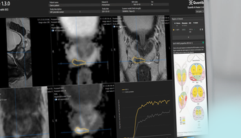 quantib-prostate.png