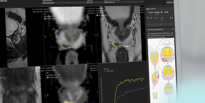 quantib-prostate.png