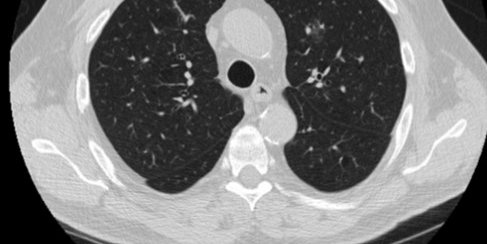 riverain-clearread-ct-detect.jpg
