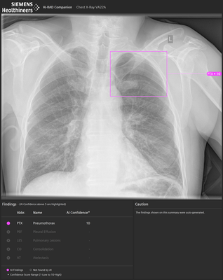 siemens-rad-companion-chest-x-ray.png