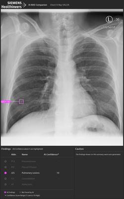 siemens-rad-companion-chest-x-ray_1.png