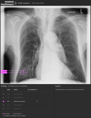 siemens-rad-companion-chest-x-ray_2.png