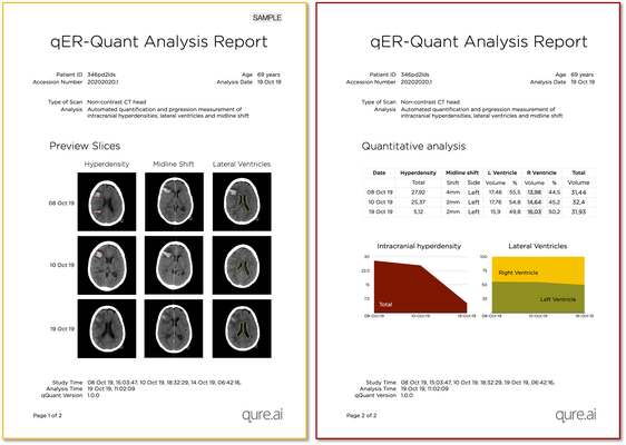 qER - Qure.ai